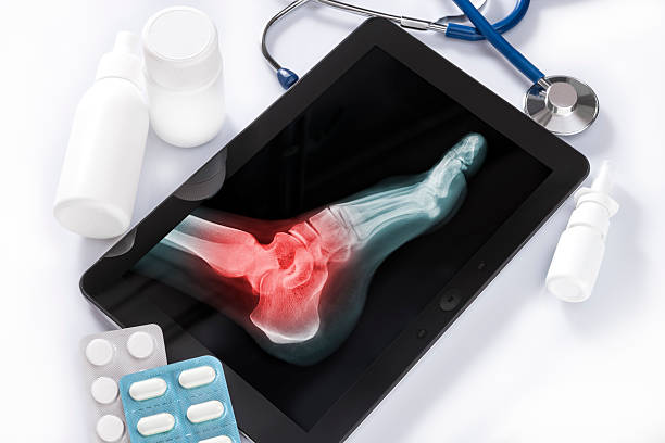 wellhealthorganic surgery for wrist and ankle injuries wellhealthorganic surgery for wrist and ankle injuries